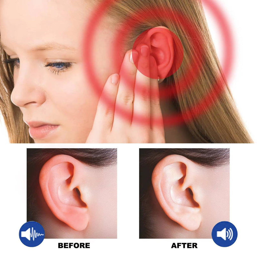 2-Pack Tinnitus Relief Ear Drops for Ringing Ears