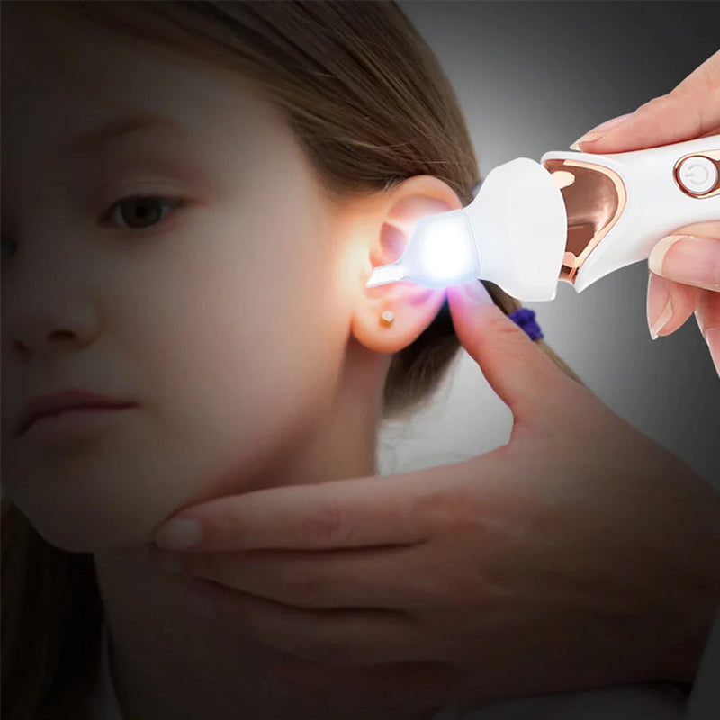 5-in-1 Electric Earwax Remover Kit - Gentle, Safe Ear Cleaning