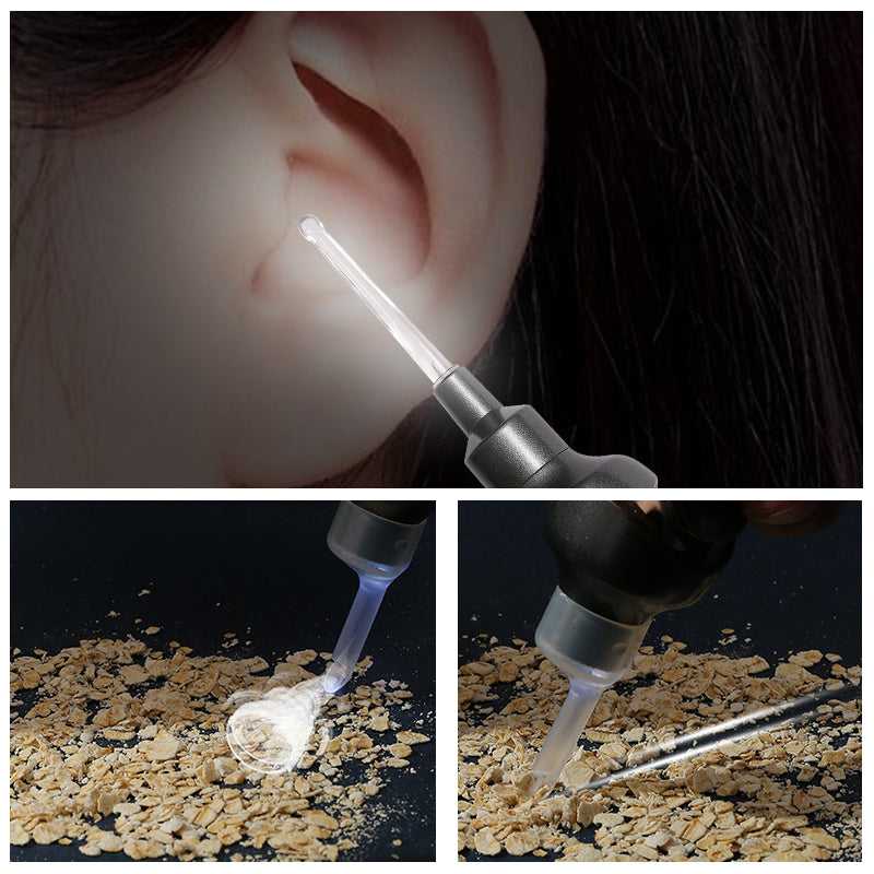 5-in-1 Electric Earwax Remover Kit - Gentle, Safe Ear Cleaning