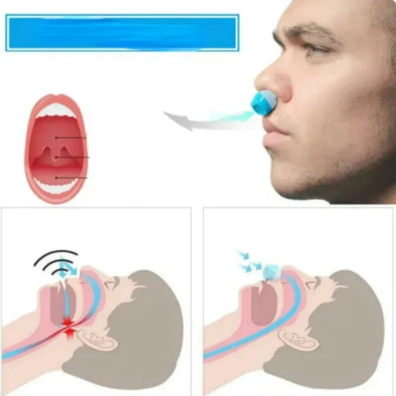 2-in-1 Snore-Reduction Device and Air-Purifying Nose Clip for Peaceful Sleep
