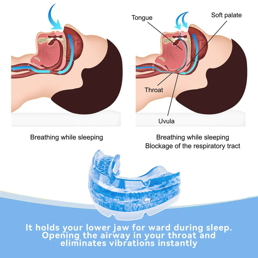 Adjustable Anti-Snore Mouthpiece for a Quieter, More Restful Sleep